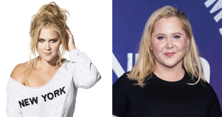 amy schumer